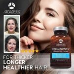 FoliGROWTH? Hair Growth Supplement for Thicker Fuller Hair | Approved* by the American Hair Loss Association | Revitalize Thinning Hair, Backed by 20 Years of Experience in Hair Loss Treatment Clinics - Image 2